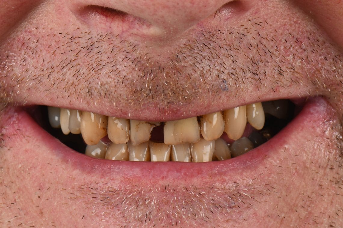 before-ddd before-ddd